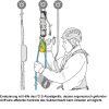 Petzl® Reversibles Rettungskit Arbeitsschutz für Höhenarbeiter