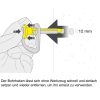 Petzl Entfernbarer Bohrhaken COEUR PULSE