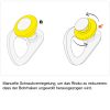 Petzl Entfernbarer Bohrhaken COEUR PULSE